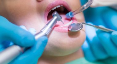 Cirugía oral Clínica Dental Benicarló